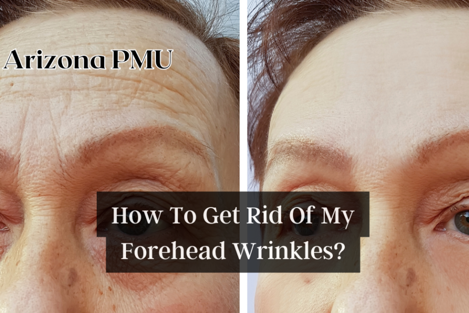 How To Get Rid Of My Forehead Wrinkles?