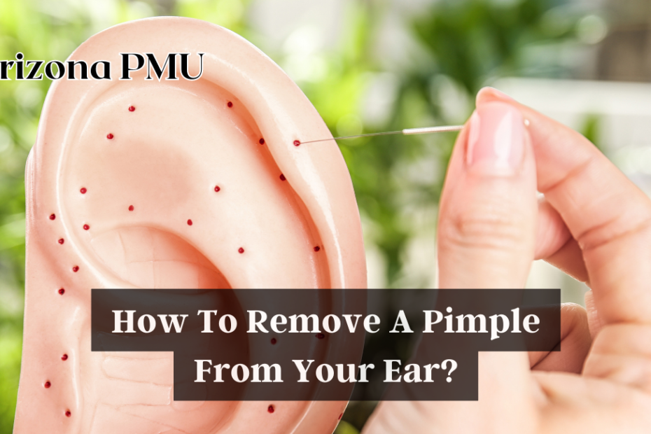 How To Remove A Pimple From Your Ear?