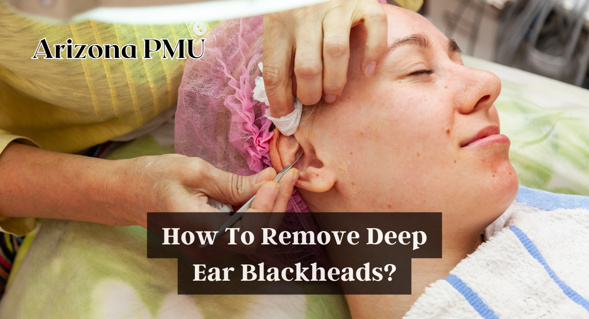 How To Remove Deep Ear Blackheads?