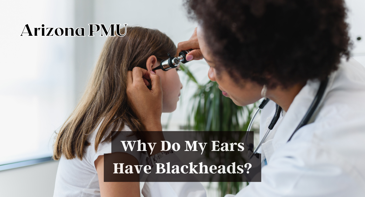 Why Do My Ears Have Blackheads?