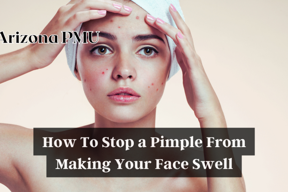 How To Stop A Pimple From Making Your Face Swell?